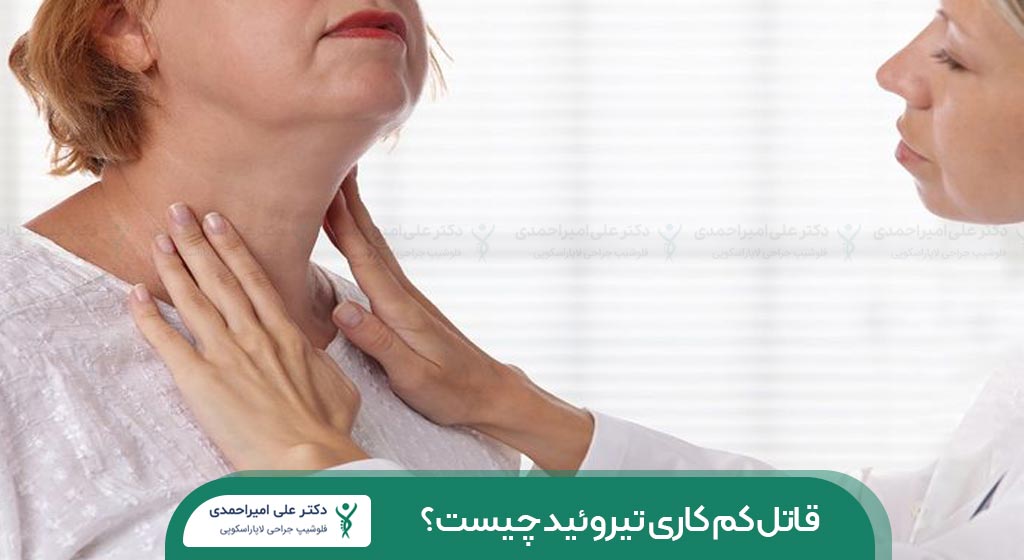 قاتل کم کاری تیروئید چیست؟