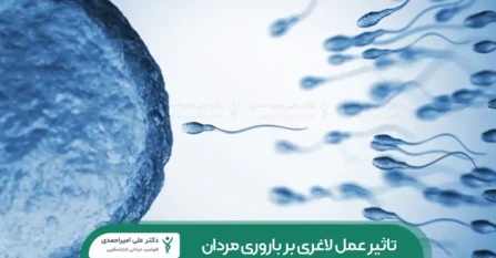 تاثیر جراحی لاغری بر باروری مردان شاخص