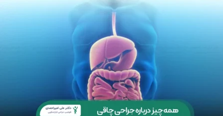 جراحی چاقی شاخص