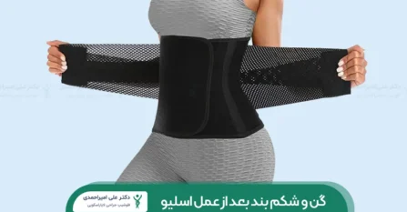 شکم بند بعد از عمل اسلیو معده شاخص