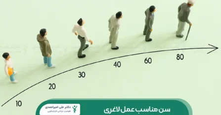 سن مناسب عمل لاغری شاخص