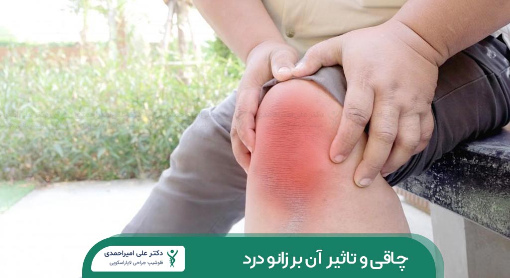 چاقی و تاثیر آن بر زانو درد