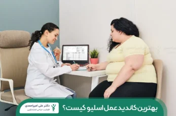 بهترین کاندید عمل اسلیو شاخص