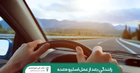 رانندگی بعد از عمل اسلیو معده شاخص