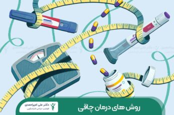 روش های درمان چاقی