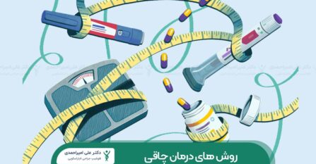 روش های درمان چاقی