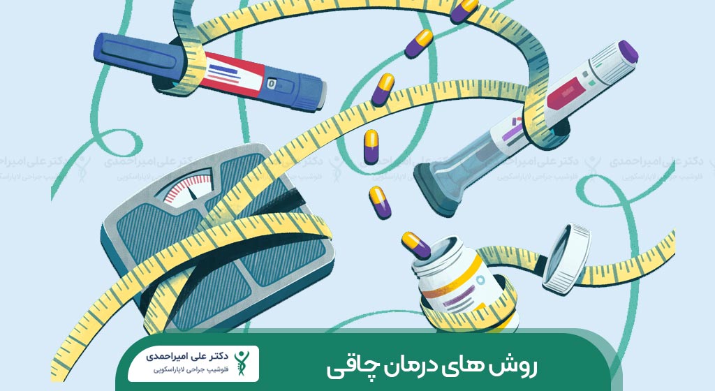 روش های درمان چاقی