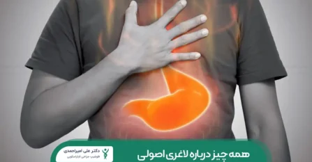 سوزش معده بعد از عمل اسلیو معده شاخص