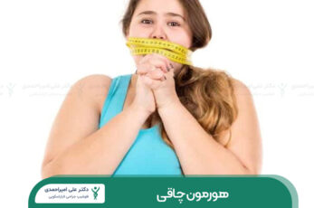 هورمون چاقی