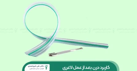 درن بعد از عمل لاغری شاخص