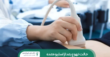 سونوگرافی قبل از اسلیو معده شاخص
