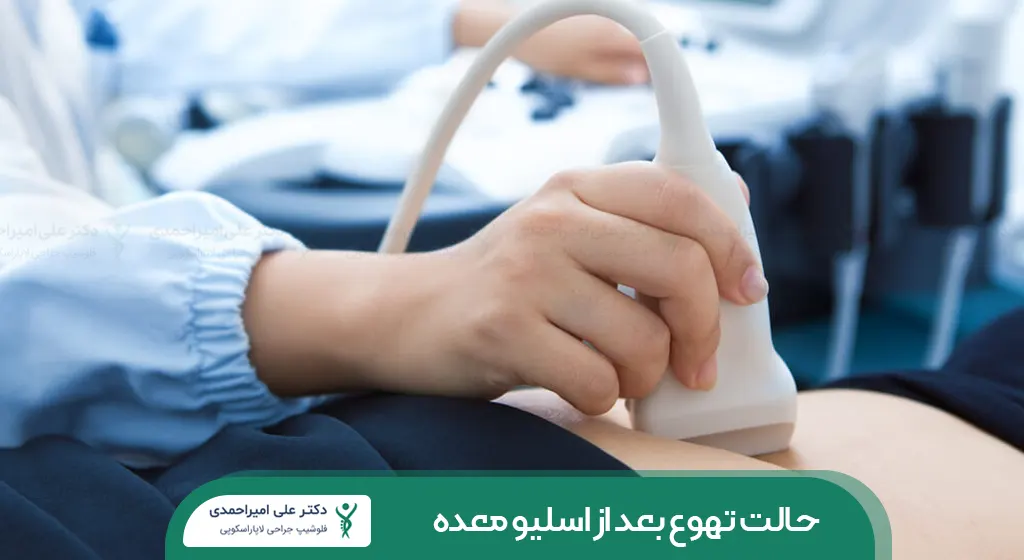 سونوگرافی قبل از اسلیو معده شاخص